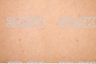 Skin texture of Moric 0002